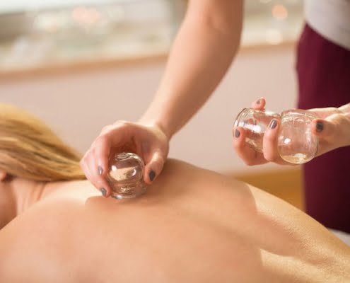 Cupping-Therapy